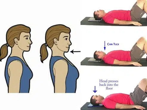 PhysiPhysiotherapy Exercises for Neck Pain otherapy Exercises for Neck Pain 