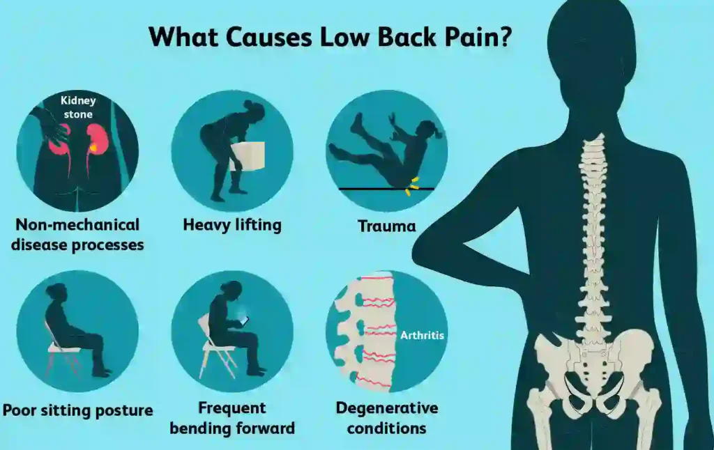 Cause of lower back pain