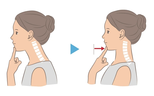 The Physio Fix Chin tuck